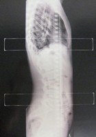 Related Picture